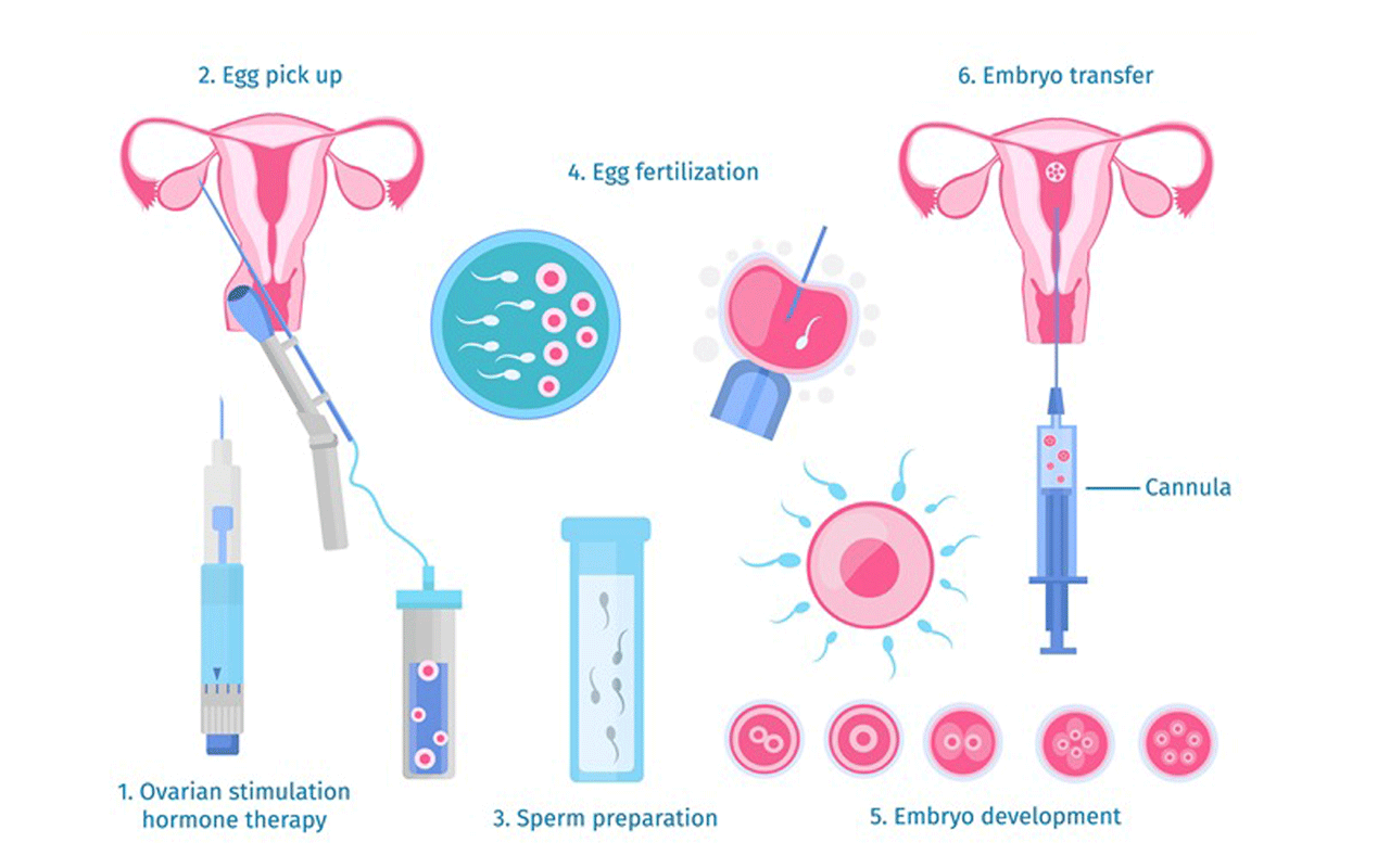 Test Tube Baby process